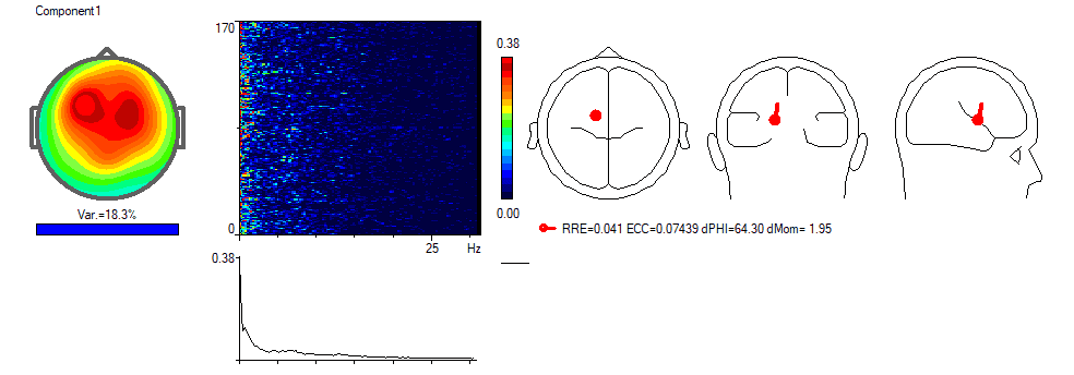 Localización del foco de la zona alterada del cerebro anterior Queeg